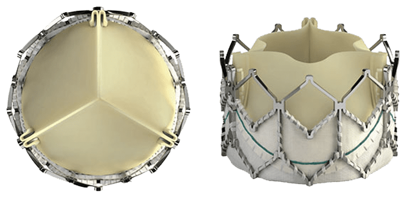 TAVR Valve