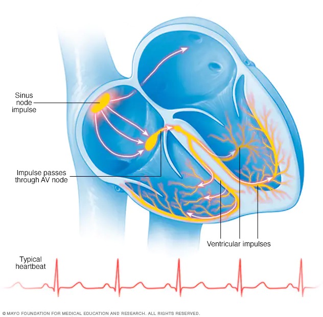 Typical heartbeat illustration