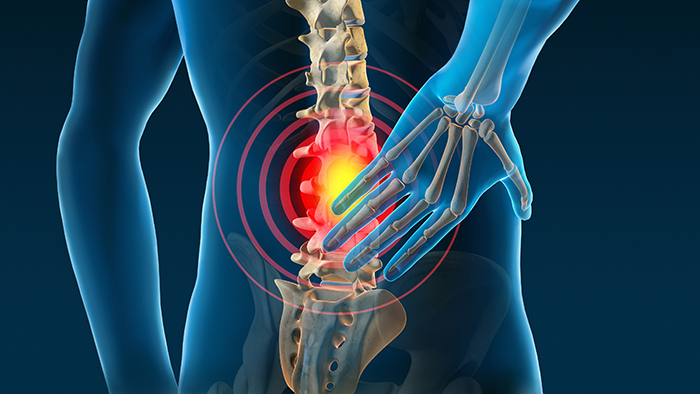 Illustration of spinal cord pain