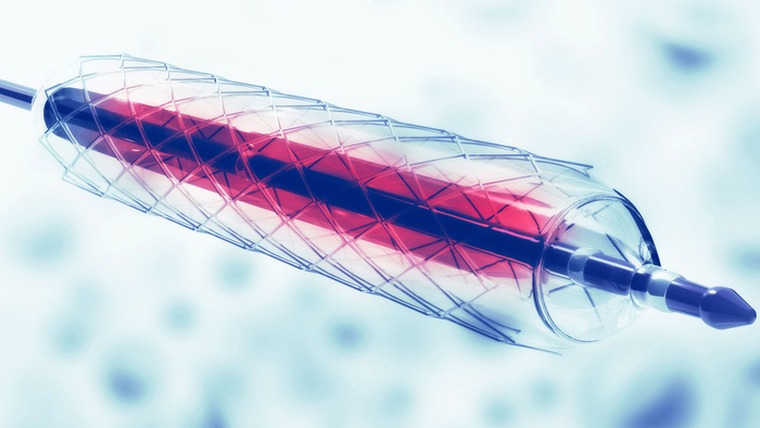 Graphic of interventional device