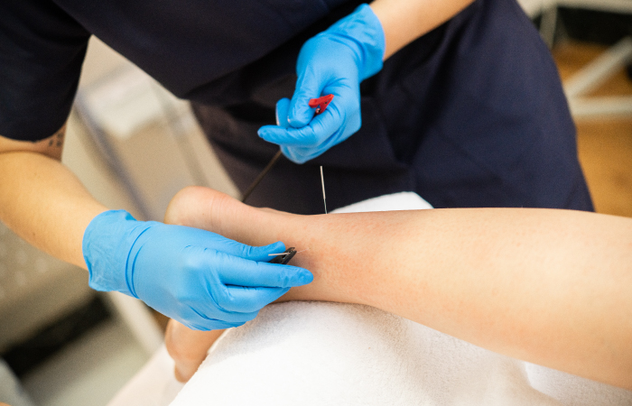 St John's Services Rehabilitation Dry Needling