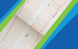An EKG with a blue and green background behind it
