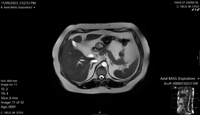 Image of Abdomen in Open MRI
