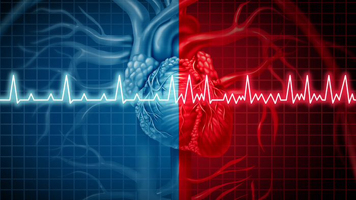 September is AFib Awareness Month