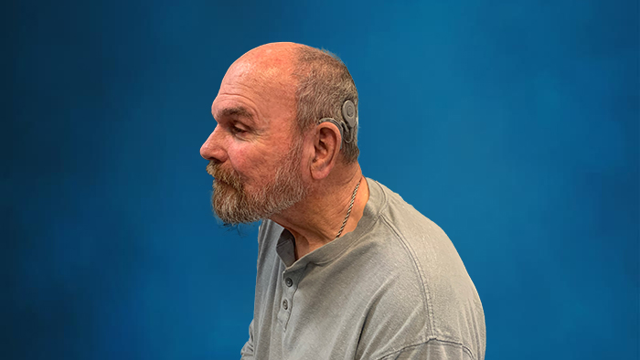 Ricki with his cochlear implant