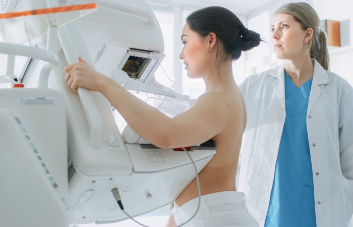 Five myths about mammograms